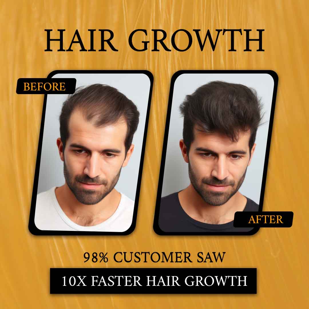 Bumper Offer💥 63% Off Buy 3 Bottles in just Rs 2999/-